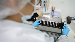 Fiocruz obtém patente para tratamento contra malária resistente